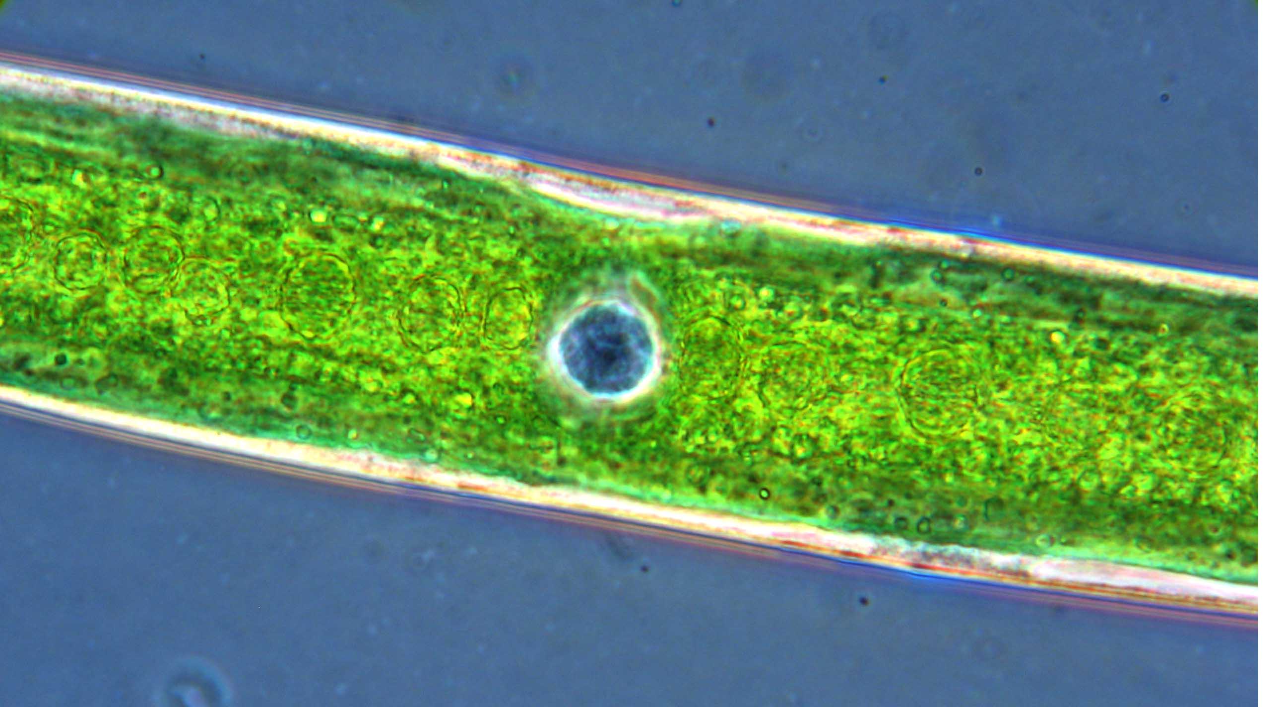 Closterium acerosum